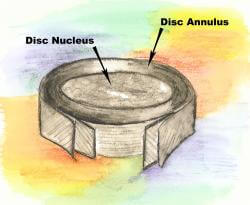 Cross section of a spinal disc - disc nucleus, disc annulus